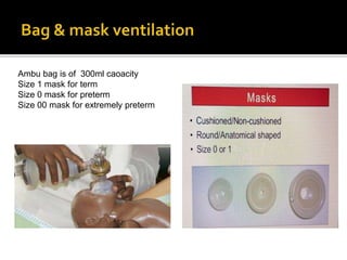 Ambu bag is of 300ml caoacity
Size 1 mask for term
Size 0 mask for preterm
Size 00 mask for extremely preterm
 