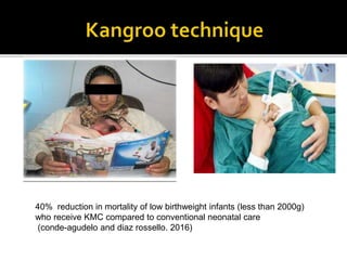 40% reduction in mortality of low birthweight infants (less than 2000g)
who receive KMC compared to conventional neonatal care
(conde-agudelo and diaz rossello. 2016)
 