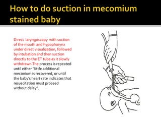 Direct laryngoscopy with suction
of the mouth and hypopharynx
under direct visualization, followed
by intubation and then suction
directly to the ET tube as it slowly
withdrawn.The process is repeated
until either ‘‘little additional
meconium is recovered, or until
the baby’s heart rate indicates that
resuscitation must proceed
without delay’’.
 