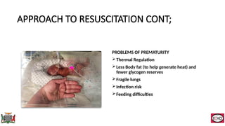 Neonatal Resuscitation describing the practices in Zambia | PPTX