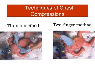 NEONATAL RESUSCITATION protocols in infants.ppt