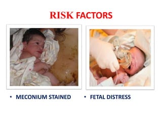 RISK FACTORS
• MECONIUM STAINED • FETAL DISTRESS
 