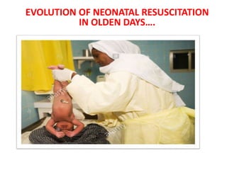 EVOLUTION OF NEONATAL RESUSCITATION
IN OLDEN DAYS….
 