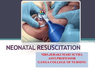 NEONATAL RESUSCITATION
MRS.JEBAKUMARI SUTHA
ASST.PROFESSOR
GANGA COLLEGE OF NURSING
 