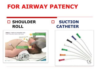 FOR AIRWAY PATENCY
 SHOULDER
ROLL
 SUCTION
CATHETER
 