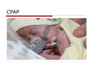 CPAP
 