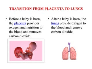 TRANSITION FROM PLACENTA TO LUNGS
• Before a baby is born,
the placenta provides
oxygen and nutrition to
the blood and removes
carbon dioxide
• After a baby is born, the
lungs provide oxygen to
the blood and remove
carbon dioxide.
 