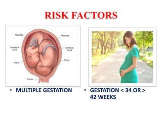 RISK FACTORS
• MULTIPLE GESTATION • GESTATION < 34 OR >
42 WEEKS
 