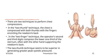 neonatal resuscitation IN HOSPITAL (1).pptx