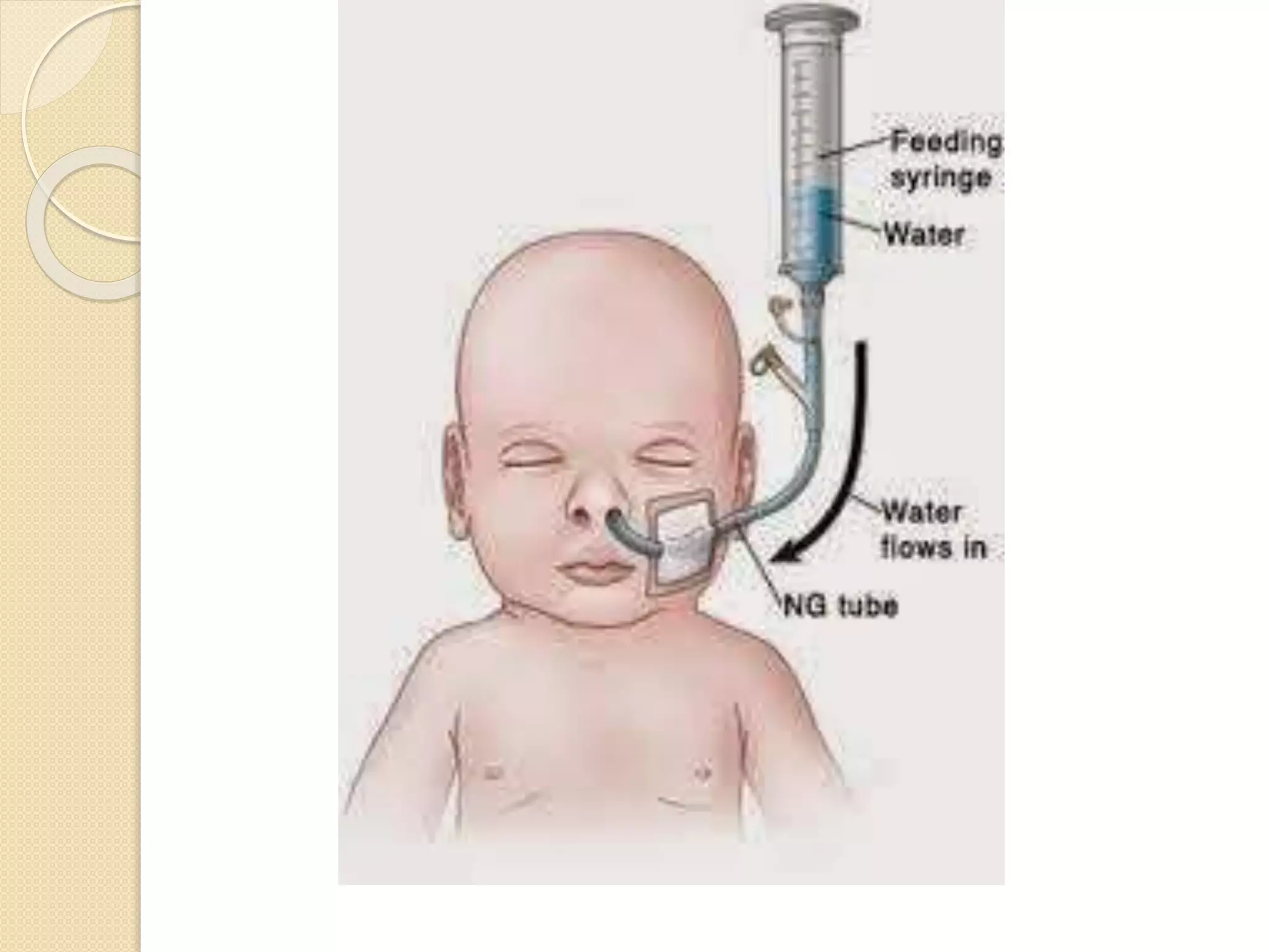 NEONATAL RESUSCITATION AND LOW BIRTH WEIGHT BABIES | PPTX