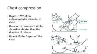 Neonatal resuscitation [autosaved] | PDF