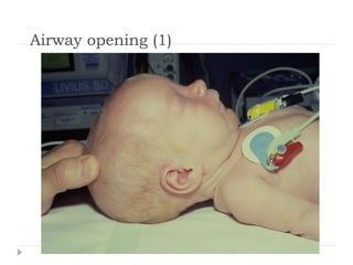 NEONATAL RESUSCITATION [Autosaved] 2018.ppt