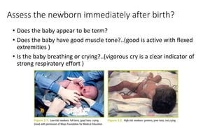 Neonatal Resuscitation Program NRP | PPTX