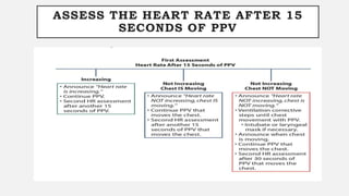 ASSESS THE HEART RATE AFTER 15
SECONDS OF PPV
 