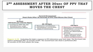 2ND ASSESSMENT AFTER 30sec OF PPV THAT
MOVES THE CHEST
 