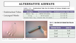 ALTERNATIVE AIRWAYS
• Endotracheal Tubes
• Laryngeal Masks
 