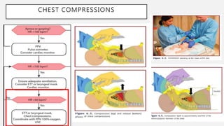 CHEST COMPRESSIONS
 