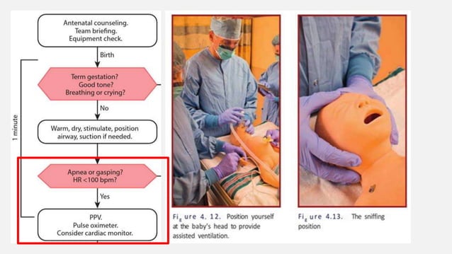 Neonatal Resuscitation Triangle