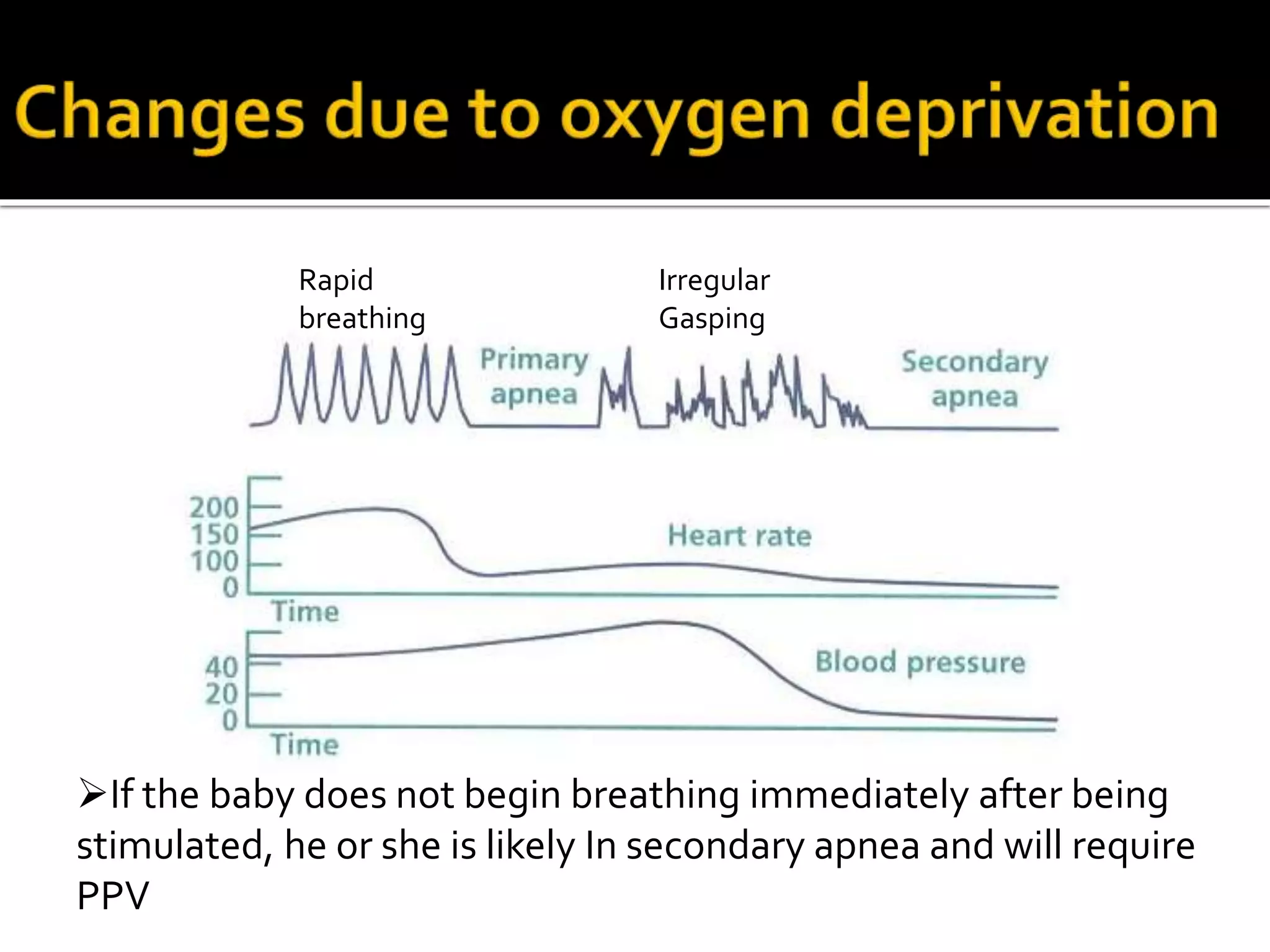 Rapid
breathing
Irregular
Gasping
If the baby does not begin breathing immediately after being
stimulated, he or she is likely In secondary apnea and will require
PPV
 