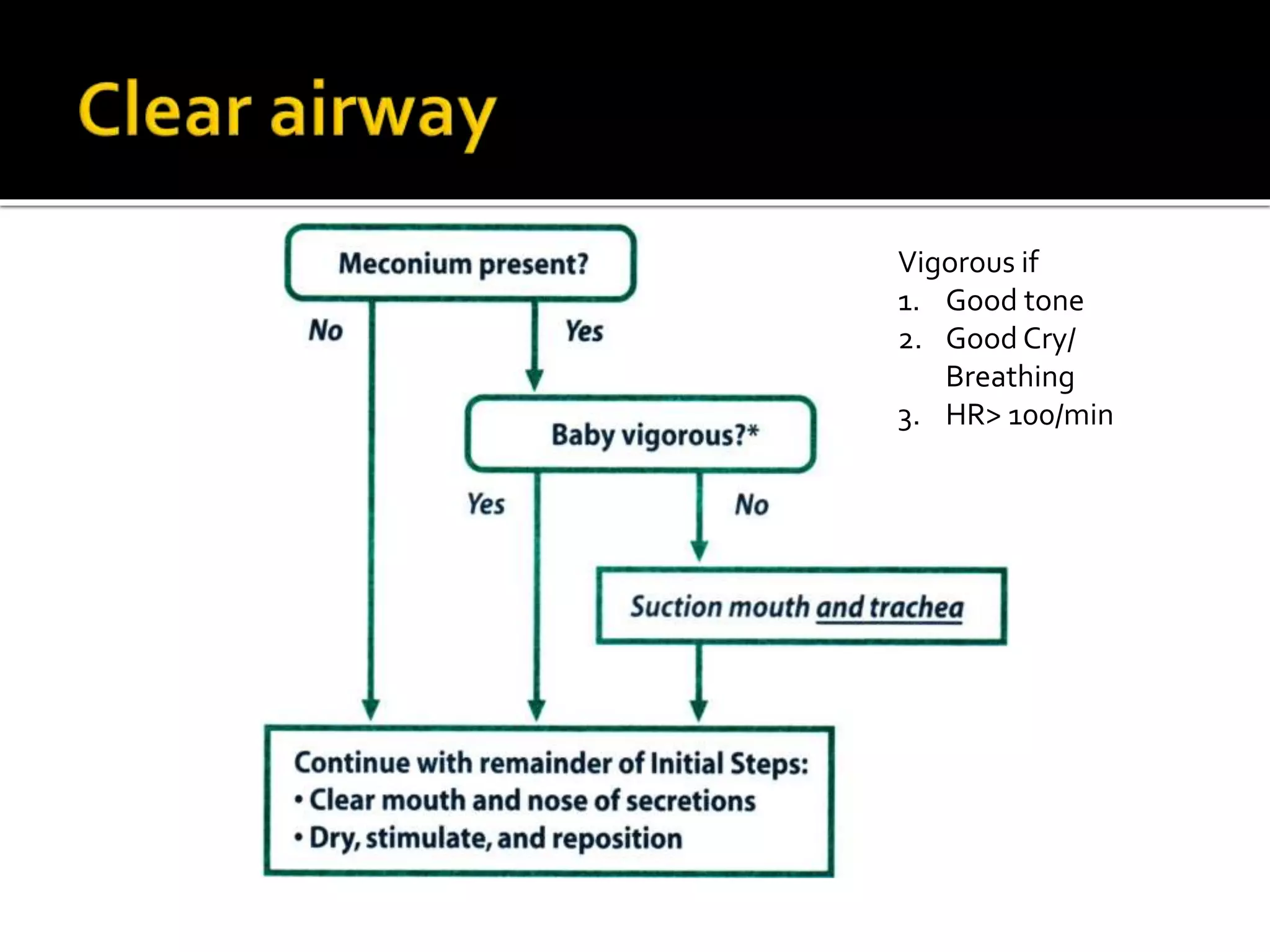 Vigorous if
1. Good tone
2. Good Cry/
Breathing
3. HR> 100/min
 