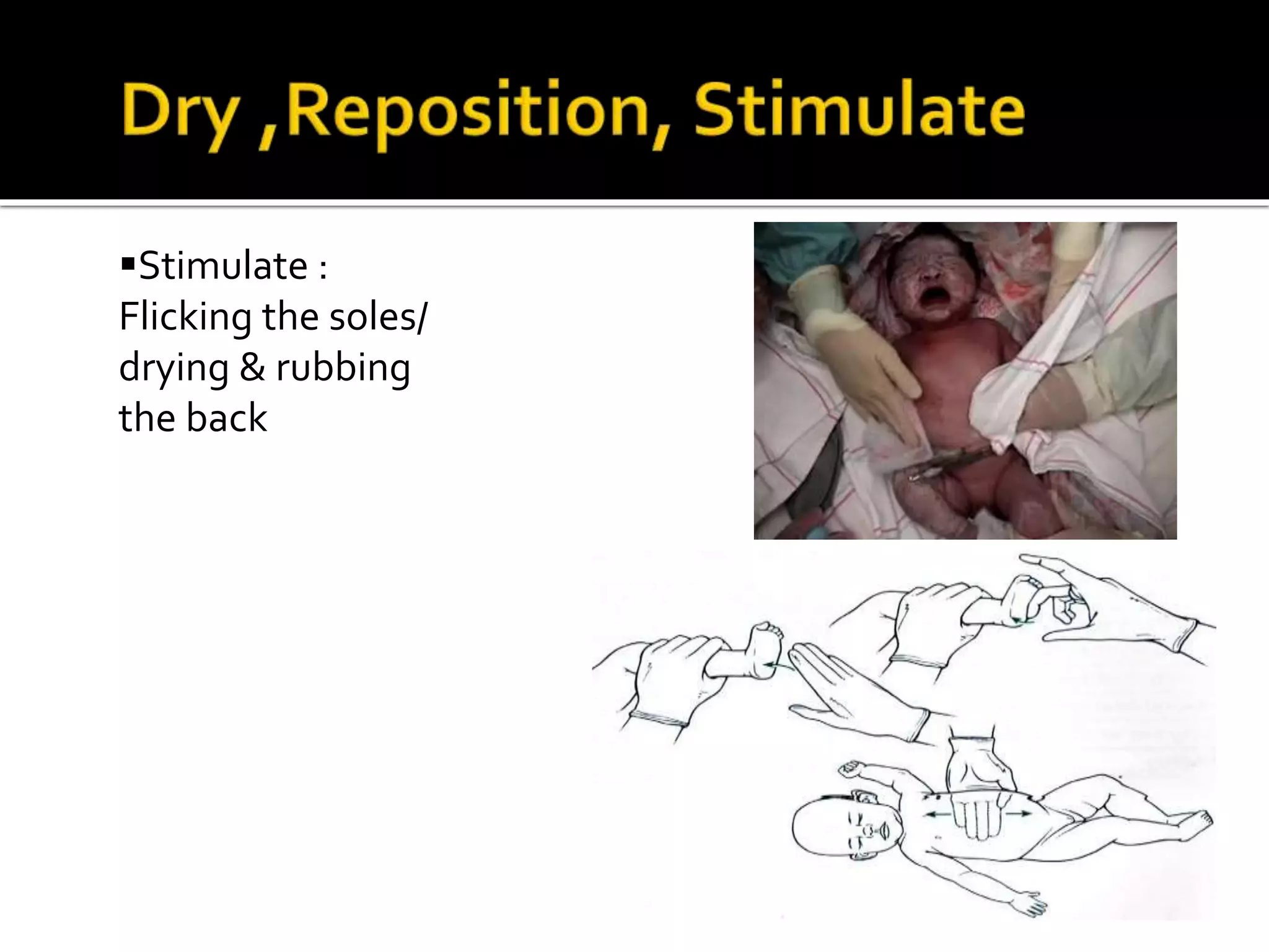 Stimulate :
Flicking the soles/
drying & rubbing
the back
 