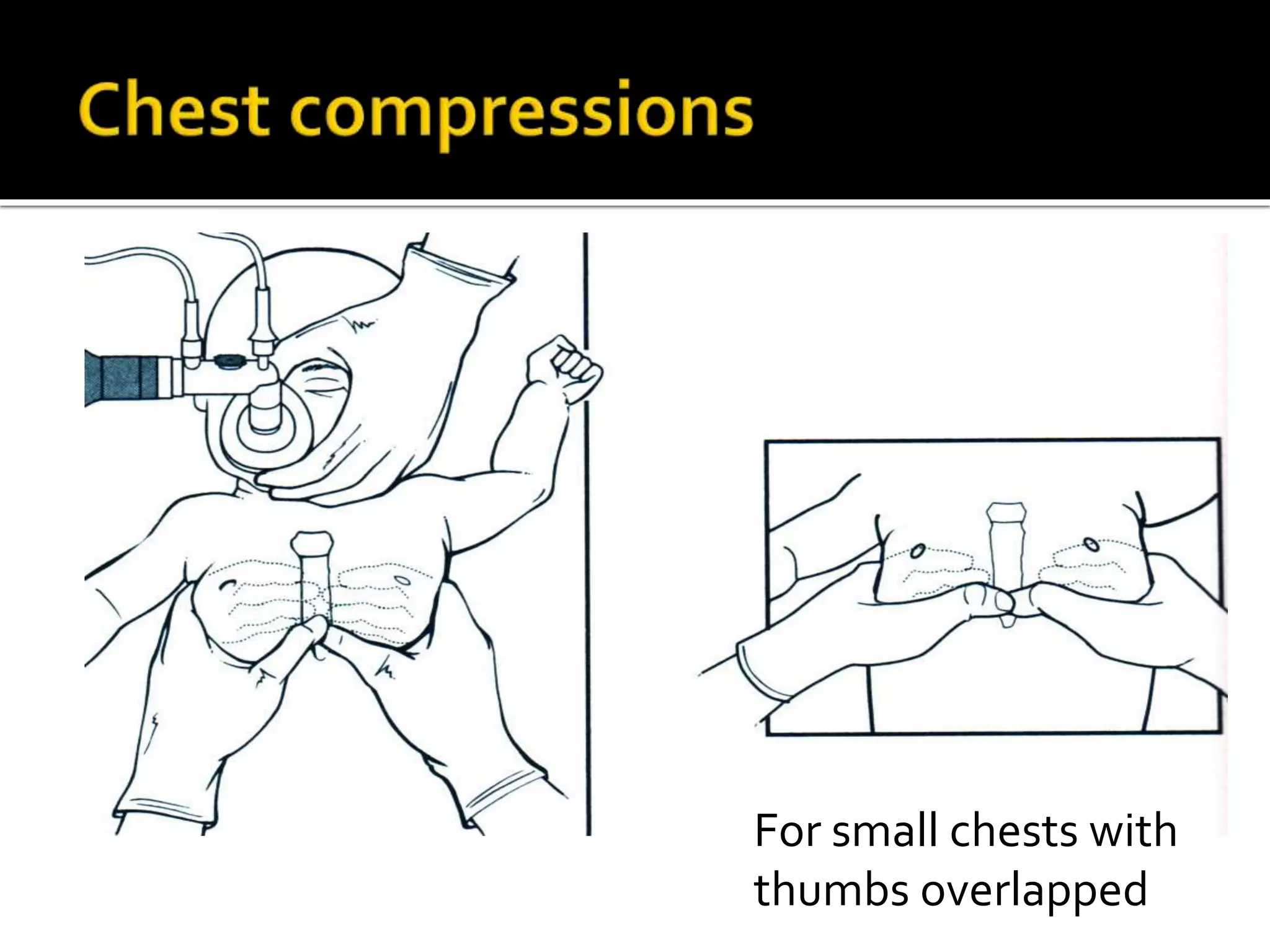 For small chests with
thumbs overlapped
 