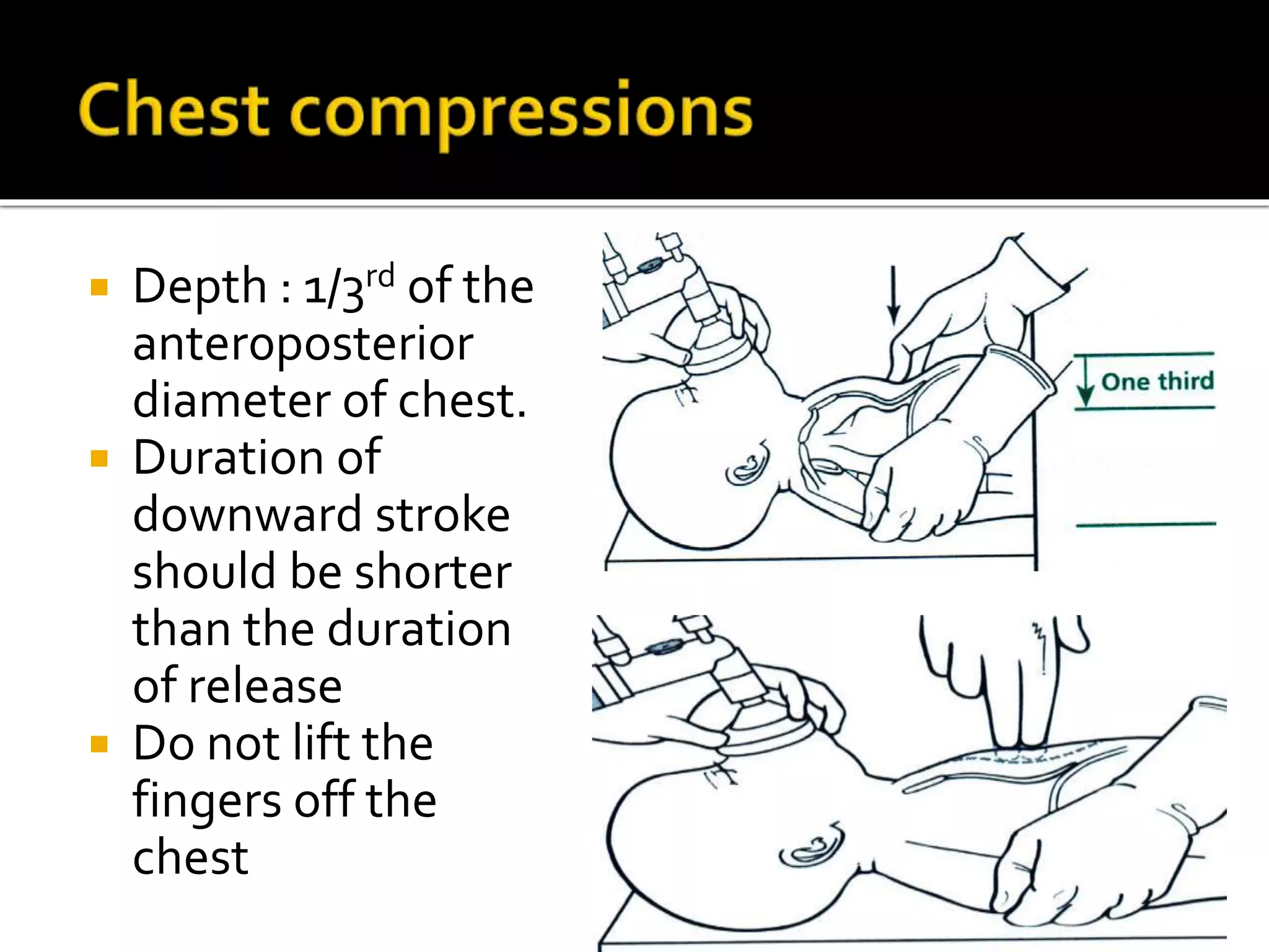  Depth : 1/3rd of the
anter0posterior
diameter of chest.
 Duration of
downward stroke
should be shorter
than the duration
of release
 Do not lift the
fingers off the
chest
 