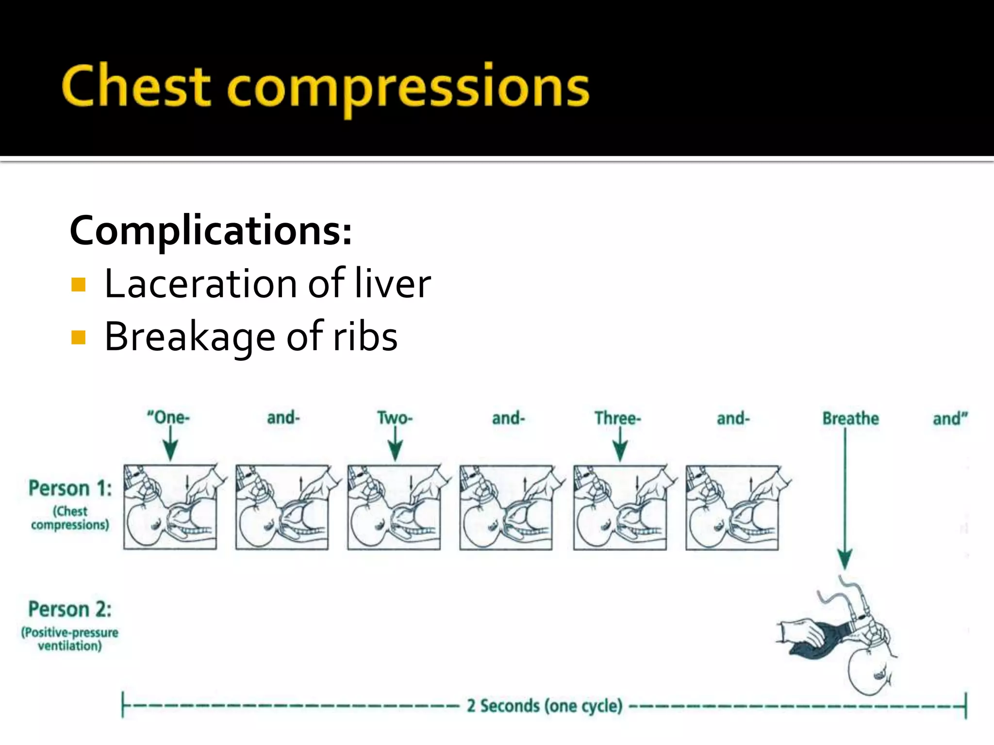 Complications:
 Laceration of liver
 Breakage of ribs
 