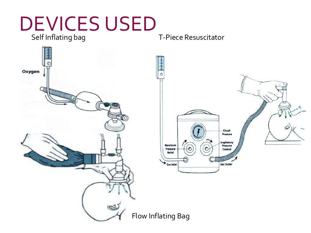 Neonatal resuscitation programme, NRP