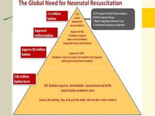 The Global Need for neonatal Resuscitation,
FIGO, Wall et al
 