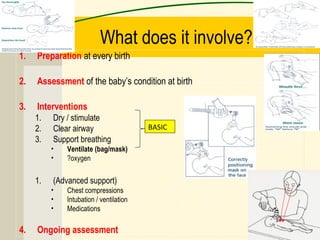 What does it involve?
1. Preparation at every birth
2. Assessment of the baby’s condition at birth
3. Interventions
1. Dry / stimulate
2. Clear airway
3. Support breathing
• Ventilate (bag/mask)
• ?oxygen
1. (Advanced support)
• Chest compressions
• Intubation / ventilation
• Medications
4. Ongoing assessment
BASIC
 