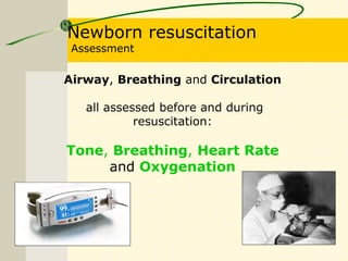 Newborn resuscitation
Assessment
Airway, Breathing and Circulation
all assessed before and during
resuscitation:
Tone, Breathing, Heart Rate
and Oxygenation
 