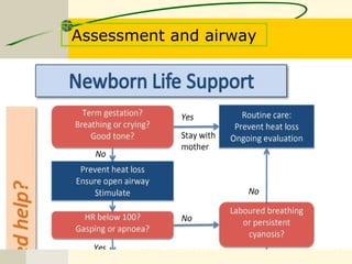 Assessment and airway
 