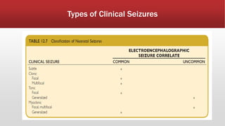 Types of Clinical Seizures
 