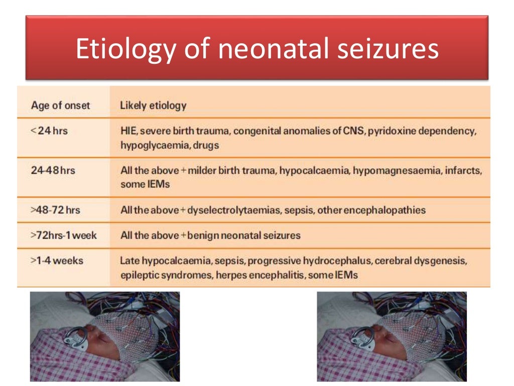 Neonatal seizures