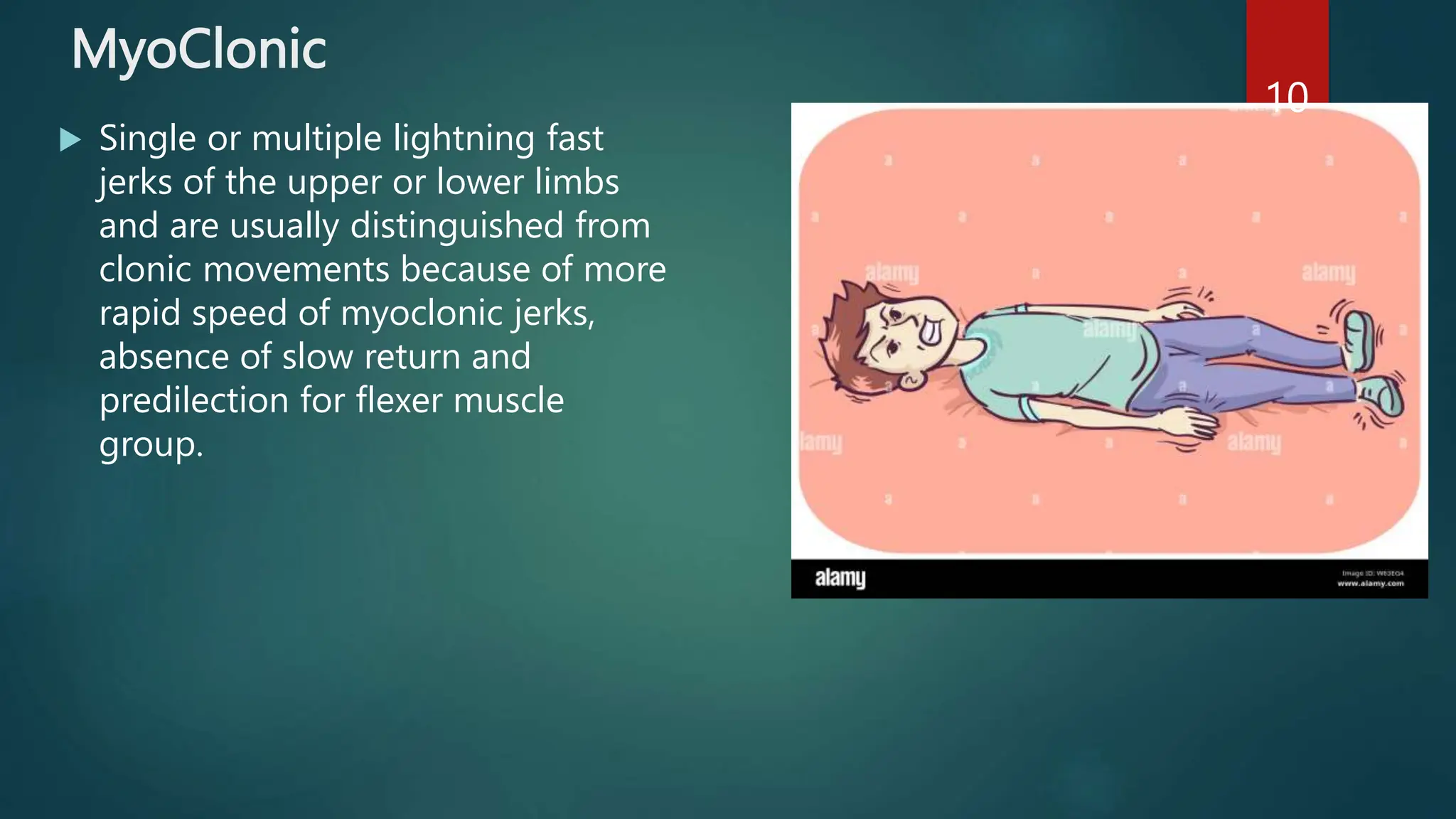 NeoNatal Seizures.pptx | Free Download