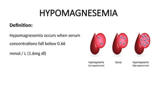 HYPOMAGNESEMIA
Definition:
Hypomagnesemia occurs when serum
concentrations fall below 0.66
mmol./ L (1.6mg dl)
 