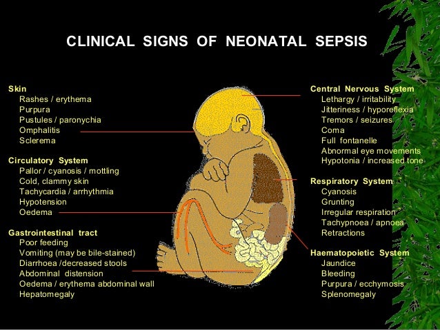 Dissertation neonatal septicemia