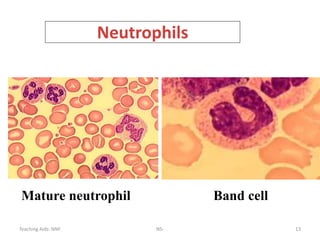 Teaching Aids: NNF NS- 13
Mature neutrophil Band cell
Neutrophils
 
