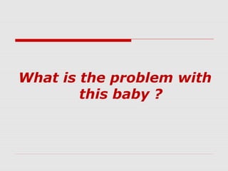 What is the problem with
this baby ?
 