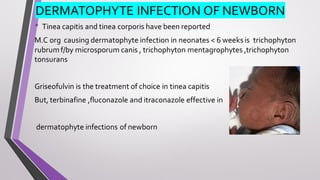 DERMATOPHYTE INFECTION OF NEWBORN
• Tinea capitis and tinea corporis have been reported
M.C org causing dermatophyte infection in neonates < 6 weeks is trichophyton
rubrumf/by microsporum canis , trichophyton mentagrophytes ,trichophyton
tonsurans
Griseofulvin is the treatment of choice in tinea capitis
But, terbinafine ,fluconazole and itraconazole effective in
dermatophyte infections of newborn
 