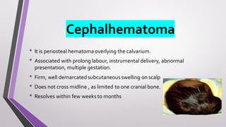 Cephalhematoma
• It is periosteal hematoma overlying the calvarium.
• Associated with prolong labour, instrumental delivery, abnormal
presentation, multiple gestation.
• Firm, well demarcated subcutaneous swelling on scalp
• Does not cross midline , as limited to one cranial bone.
• Resolves within few weeks to months
 