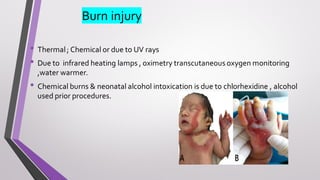 Burn injury
• Thermal; Chemical or due to UV rays
• Due to infrared heating lamps , oximetry transcutaneous oxygen monitoring
,water warmer.
• Chemical burns & neonatal alcohol intoxication is due to chlorhexidine , alcohol
used prior procedures.
 