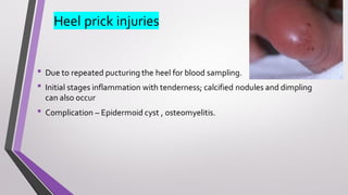 Heel prick injuries
• Due to repeated pucturing the heel for blood sampling.
• Initial stages inflammation with tenderness; calcified nodules and dimpling
can also occur
• Complication – Epidermoid cyst , osteomyelitis.
 