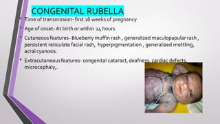 CONGENITAL RUBELLA
• Time of transmission- first 16 weeks of pregnancy
• Age of onset- At birth or within 24 hours
• Cutaneous features- Blueberry muffin rash , generalized maculopapular rash ,
persistent reticulate facial rash, hyperpigmentation , generalized mottling,
acral cyanosis.
• Extracutaneousfeatures- congenital cataract,deafness, cardiac defects,
microcephaly,.
 
