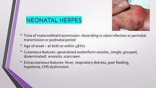 NEONATAL HERPES
• Time of maternofetal transmission- Ascending in utero infection or perinatal
transmission or postnatal period
• Age of onset – at birth or within 48 hrs
• Cutaneous features- generalized zosteriform vesicles, (single, grouped,
disseminated) erosions, scars seen.
• Extracutaneousfeatures- fever, respiratory distress, poor feeding,
hypotonia, CNS dysfunction.
 