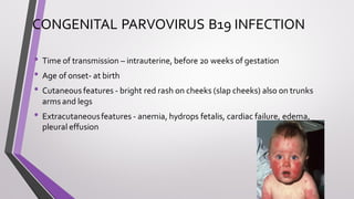 CONGENITAL PARVOVIRUS B19 INFECTION
• Time of transmission – intrauterine, before 20 weeks of gestation
• Age of onset- at birth
• Cutaneous features - bright red rash on cheeks (slap cheeks) also on trunks
arms and legs
• Extracutaneousfeatures - anemia, hydrops fetalis, cardiac failure, edema,
pleural effusion
 