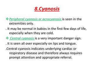 8.Cyanosis
Peripheral cyanosis or acrocyanosis is seen in the
extremities only.
. It may be normal in babies in the first few days of life,
especially when they are cold.
 Central cyanosis is a very important danger sign.
. It is seen all over especially on lips and tongue.
.Central cyanosis indicates underlying cardiac or
respiratory disease and therefore always requires
prompt attention and appropriate referral.
 