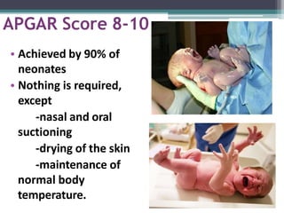 APGAR Score 8-10
 