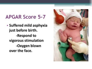 APGAR Score 5-7
• Suffered mild asphyxia
just before birth.
-Respond to
vigorous stimulation
-Oxygen blown
over the face.
 